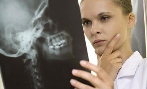 skull x-ray